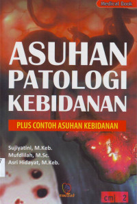 Image of Asuhan Patologi Kebidanan : Plus Contoh Asuhan Kebidanan