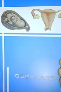 Image of Obgynacea : Obstetri & Ginekologi